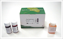 パラオキソナーゼ(PON-1:paraoxonase arylesterase活性)測定キット 酸化ストレス/抗酸化酵素 研究用