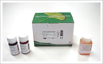 ѥ饪ʡ(PON-1:paraoxonase arylesterase)¬ꥭå ȥ쥹/ 